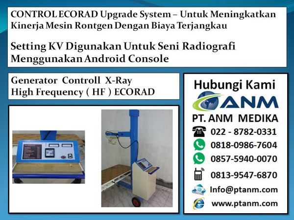 Alat Radiologi Mri. Alat Radiologi Pdf. Alat Radiologi Portable.  Harga-alat-x-ray-baru